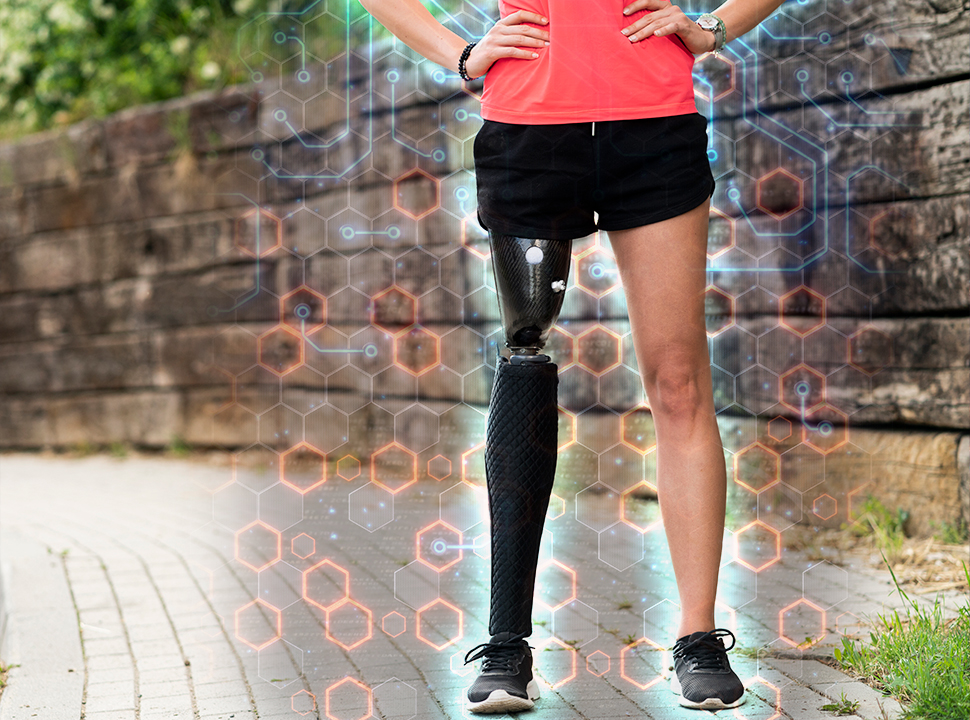 These Prostheses Help Give Amputees Motor Function and Protection