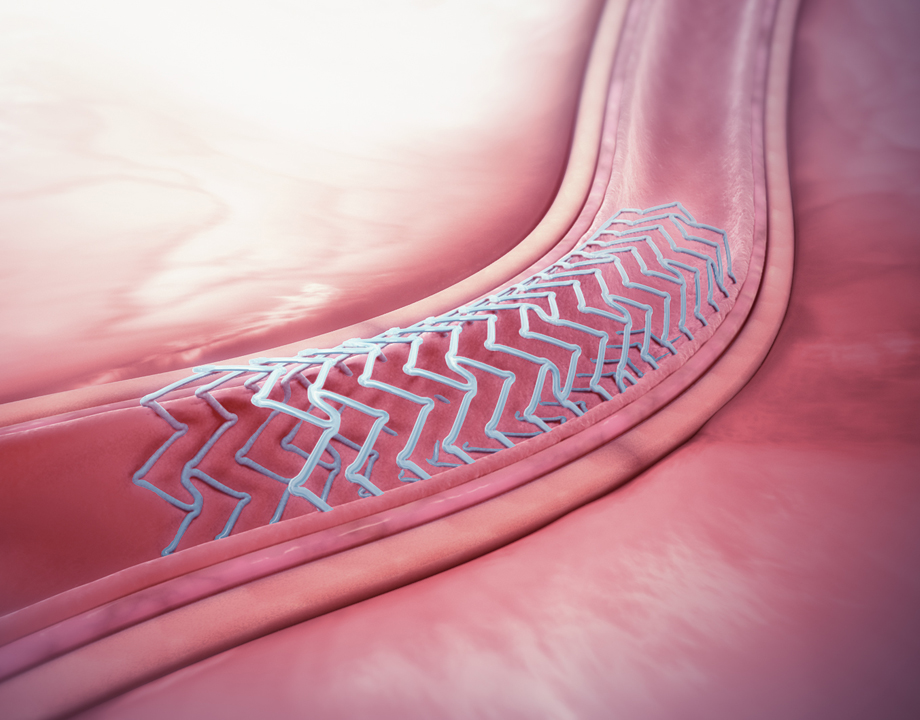 Bioresorbable Materials Boost Medical Devices - ASME